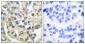 FGFR2 Antibody